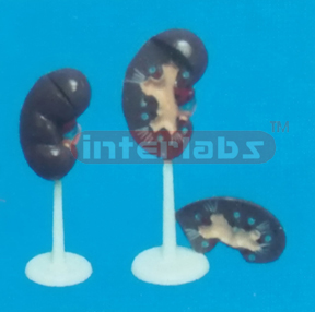 NATURAL KIDNEY MODEL WITHOUT ADRENAL GLAND